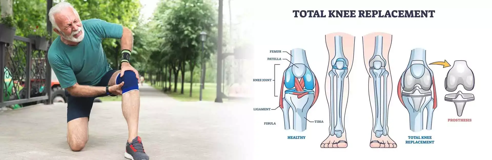 Robotic Knee Replacement Surgery in Kapurthala